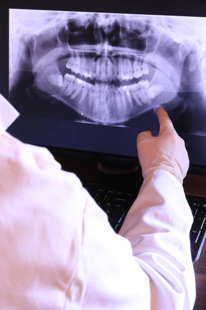 Best Emergency Wisdom Teeth Removal in Salem, NJ